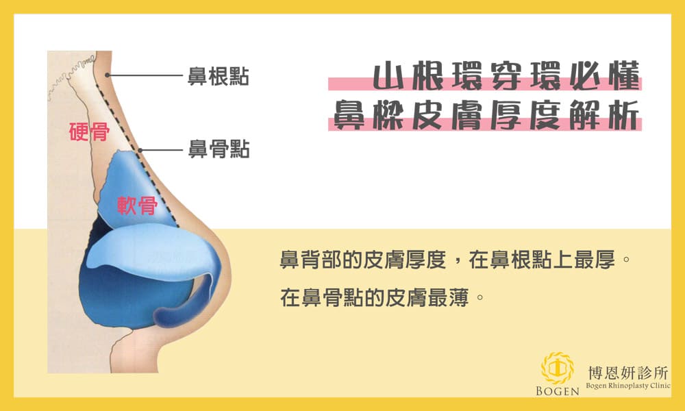 隆鼻山根環穿環必懂，鼻樑皮膚厚度解析